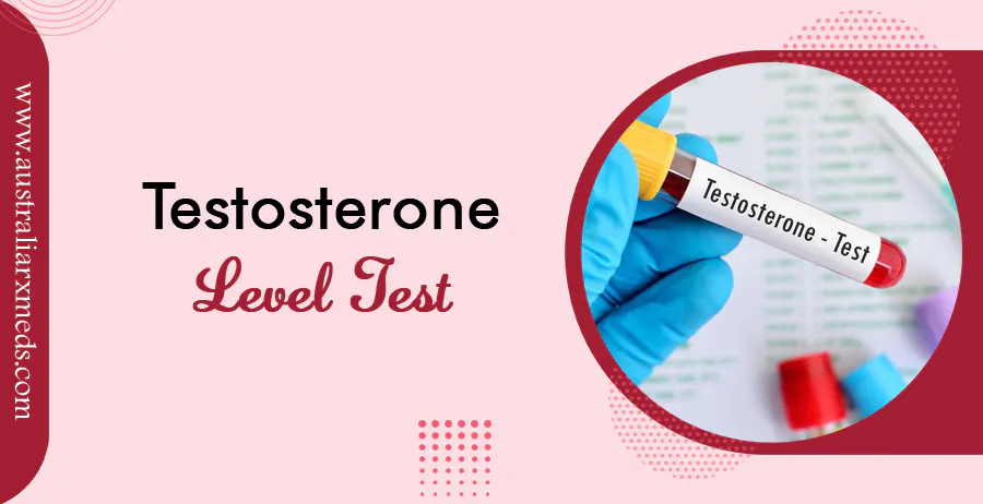 Testosterone Level Test