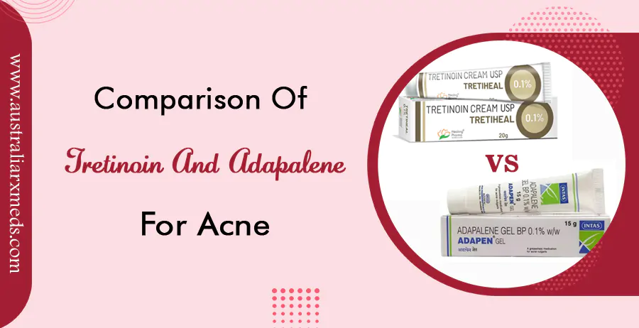 Comparison of Tretinoin and Adapalene for Acne